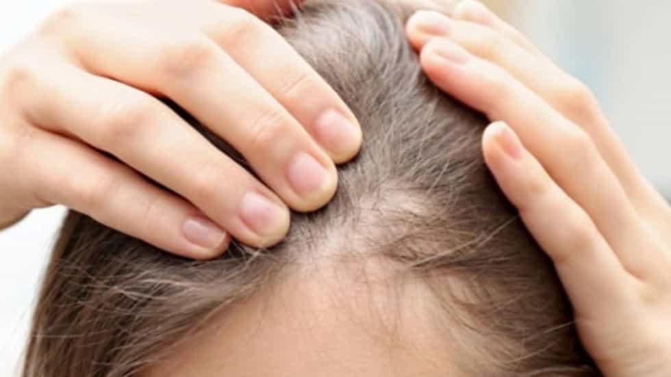 بهترین مرکز درمان ریزش و مشکلات پوست سر در ساری